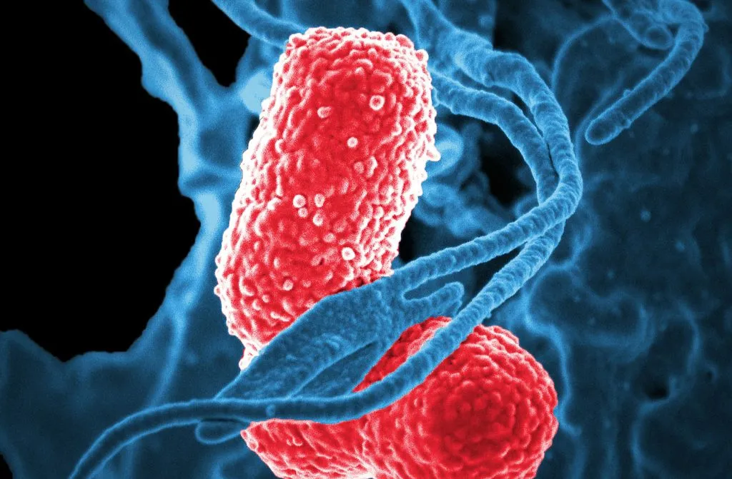 Recurrent pneumonias in elderly patients