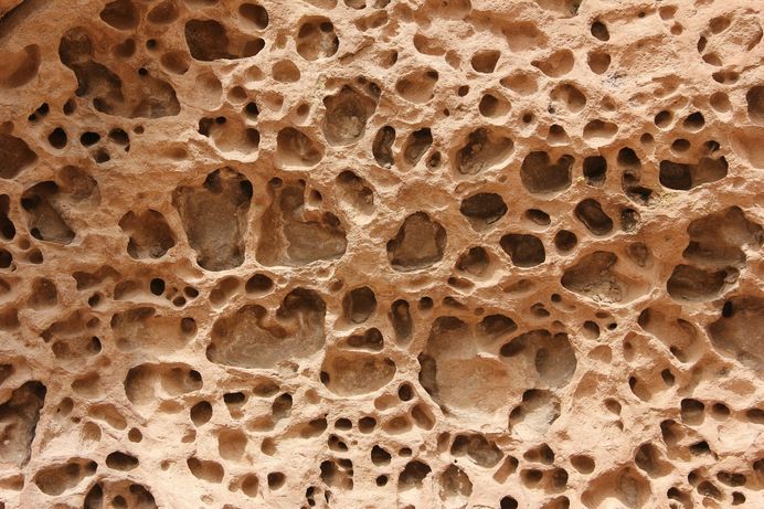 Osteoporosis: Doctors Warn of Late Diagnosis and Insufficient Treatment